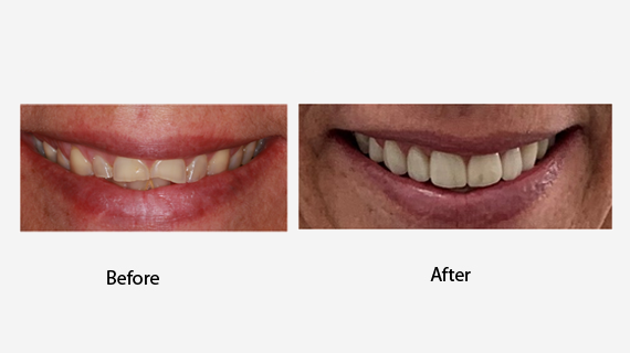 Complete Dental Care