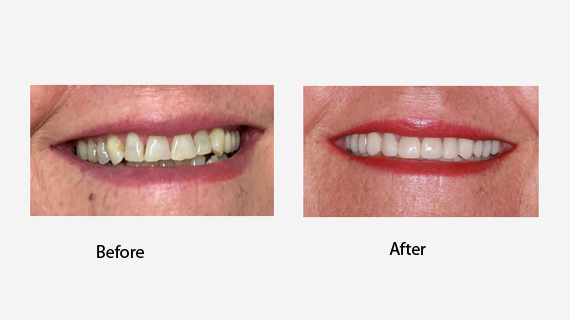 Complete Dental Care