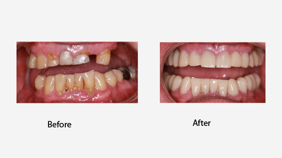 Complete Dental Care