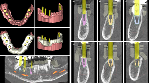 Complete Dental Care